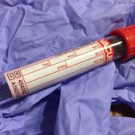 consejos para antes de un análisis de sangre, qué hacer antes de un análisis de sangre, ¿Cuántas horas de ayuno para análisis de sangre?, ¿A qué hora tengo que cenar la noche anterior a un Análisis de Sangre?, ¿Qué tengo que cenar la noche anterior a un Análisis de Sangre?, análisis de sangre, Análisis de sangre que no requieren ayuno, ¿Puedo tomar la Medicación antes del Análisis de Sangre?, ¿Puedo hacer ejercicio el día anterior a un Análisis de Sangre?, ¿Puedo Fumar antes de un Análisis de Sangre?, ¿Qué debo de hacer si me he mareado en un Análisis anterior?, ¿Qué hay que hacer para evitar el Hematoma después de un Análisis de Sangre?, ¿Puedo hacerme un Análisis de Sangre si estoy enfermo?,