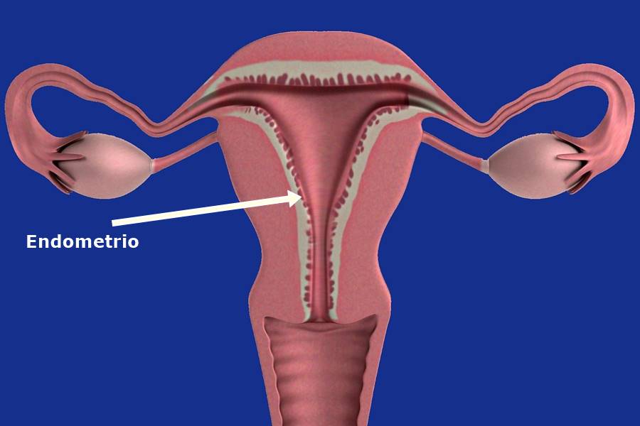 ¿Por qué sangro si tomo anticonceptivos?, ¿Por qué se produce el sangrado vaginal si estoy tomando Anticonceptivos?, ¿Cómo es el sangrado vaginal durante el ciclo menstrual?, ¿Qué anticonceptivos hormonales producen sangrado en el ciclo menstrual?, ¿Qué pasa al manchar durante el ciclo menstrual tomando anticonceptivos?, 