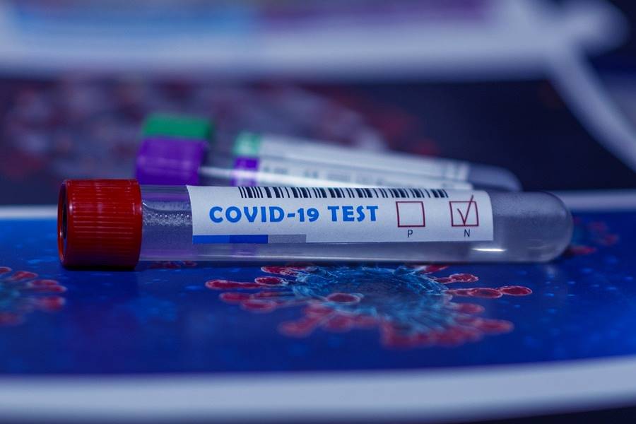 Tipos de Test para diagnosticar coronavirus, Tipos de Test para detectar coronavirus, tipos de Pruebas para detectar el coronavirus, tipos de pruebas para diagnosticar el coronavirus, para qué sirven los test de la Covid-19, clases de pruebas rápidas para la covid-19. tipos de test rápidos para el coronavirus,